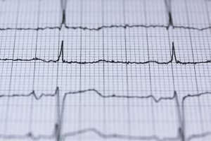 EKG diagnostics.